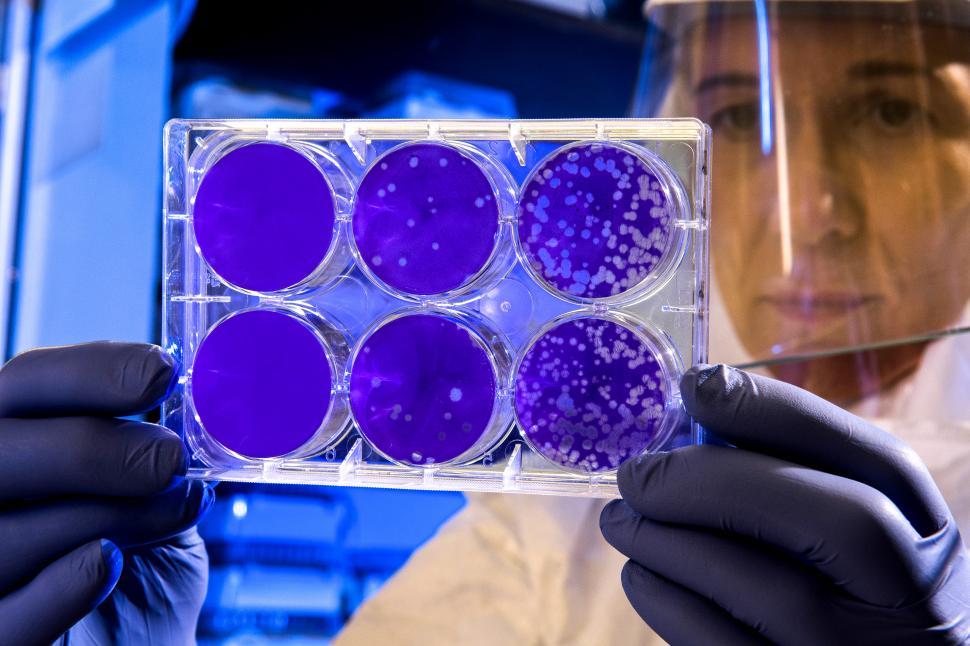Importance of Acknowledging Foodborne Illnesses